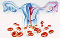 Menstruasiya Pozulmaları (qanama Və Menstruasiya Ağrıları ...