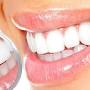 fraza.az hostundan Sağlam dişlər sağlamlığın güzgüsüdür