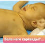 pediatr_nurgalievna - ❓Неге бала сарғаяды -Жаңа туылған ...