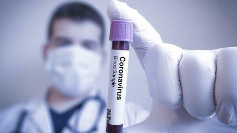 Koronavirusu 48 saata yox eden DERMAN TAPİLDİ - Mutexesisler ACİQLADİ/FOTO